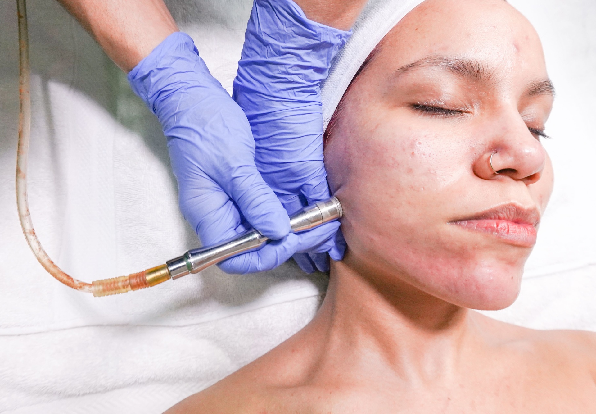 Hydro Glow Facial